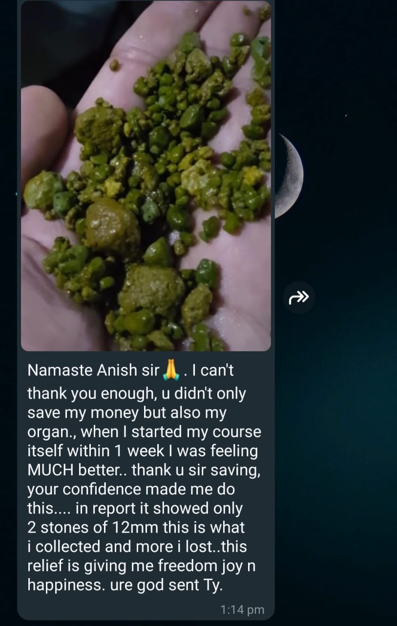 Gall bladder stone (1)